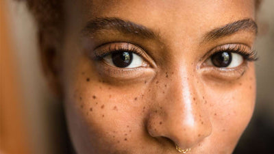 Which is the best vitamin C serum to lighten dark spots on face skin?