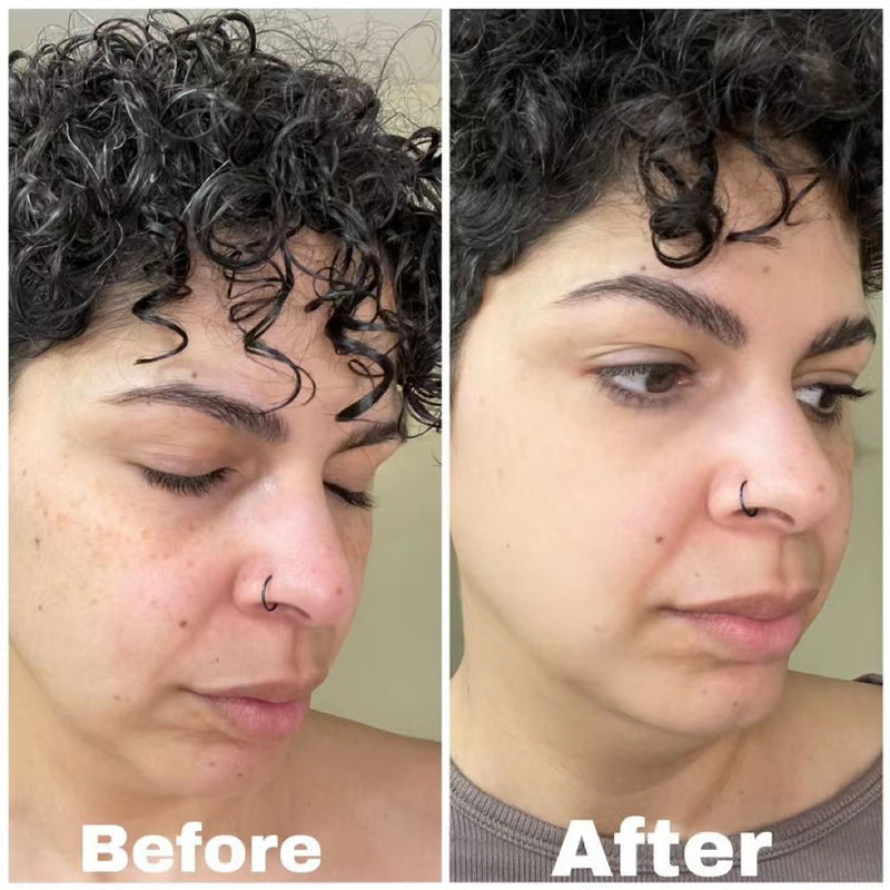 before and after of vitamin c serum