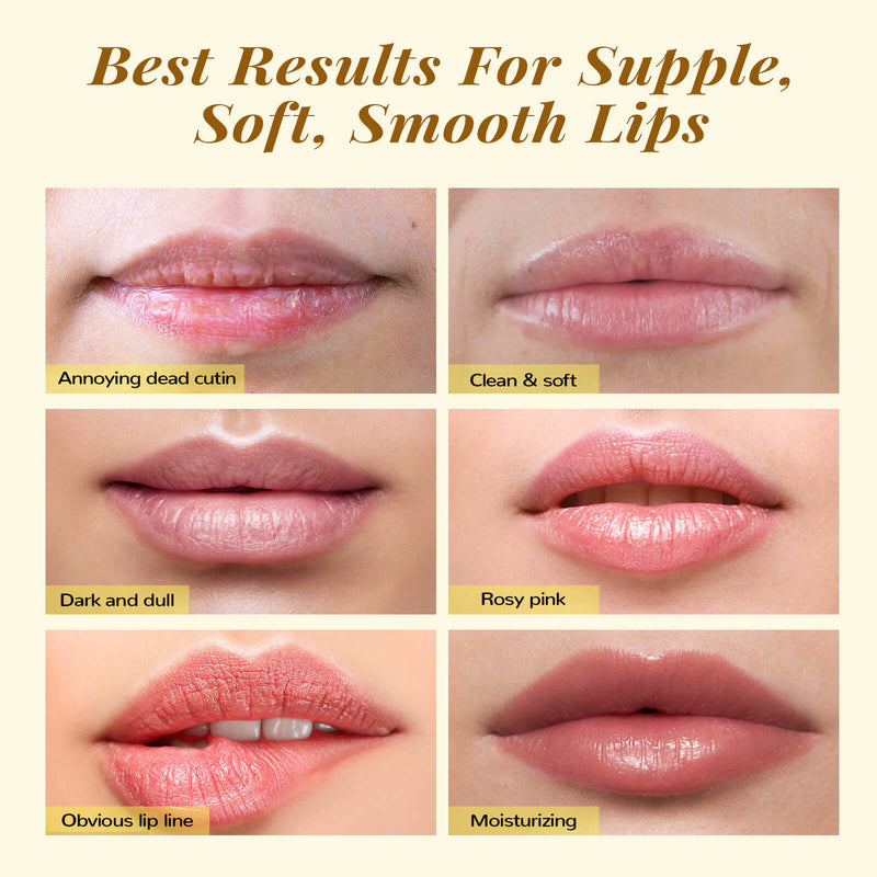 Lip carte kit for dry lips