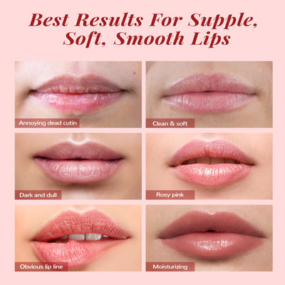 ANAIRUI Lip Care Kit - Lip Mask &  Sugar Scrub Set  - for Dry Chapped Cracked Peel Lips Repair (Berries + VC)