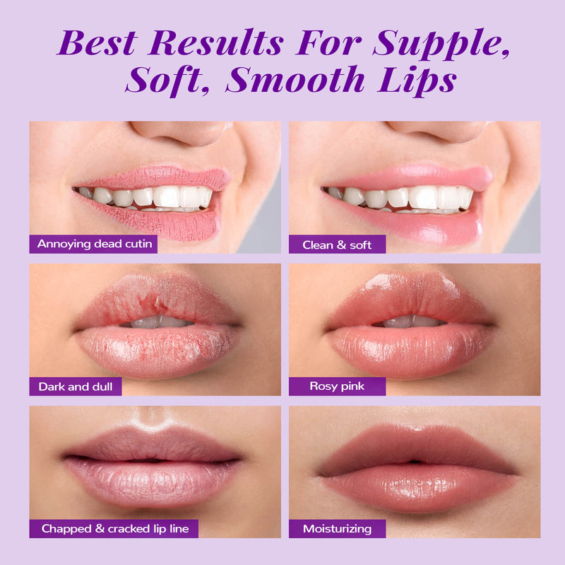 ANAIRUI  Bakuchiol & Grape Lip Mask Set  for Lip Treatment, Moisturizing Lips, Dry, Chapped, Peel & Dark Lips