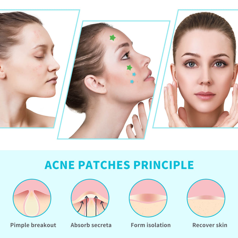 acne patch benefits